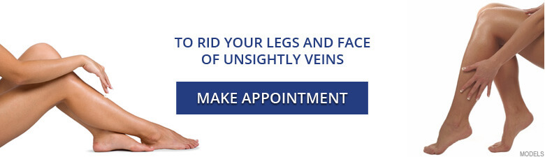 Click here to make your Spider Vein Treatment appointment